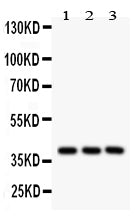 Anti-PTGER2 Picoband antibody, PB9386, Western blotting
All lanes: Anti PTGER2 (PB9386) at 0.5ug/ml

Lane 1: Human Placenta Tissue Lysate at 50ug

Lane 2: A549 Whole Cell Lysate at 40ug

Lane 3: HEPG2 Whole Cell Lysate at 40ug

Predicted bind size: 40KD

Observed bind size: 40KD