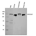 Anti-ROCK2 Antibody Picoband®