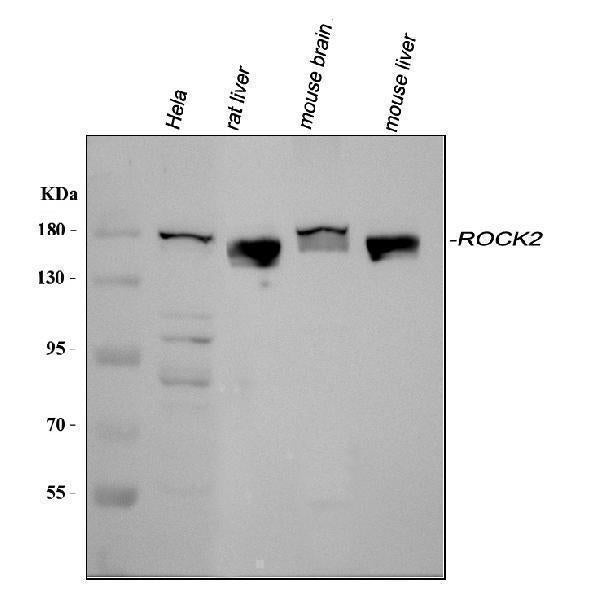 Anti-ROCK2 Antibody Picoband®