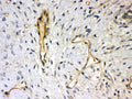 Anti-Syndecan 4 Picoband antibody, PB9388, IHC(P)
IHC(P): Human Mammary Cancer Tissue