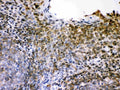 Anti-L-selectin Picoband antibody, PB9389,  IHC(P)
IHC(P): Human Tonsil Tissue