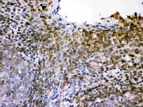 Anti-L-selectin Picoband antibody, PB9389,  IHC(P)
IHC(P): Human Tonsil Tissue