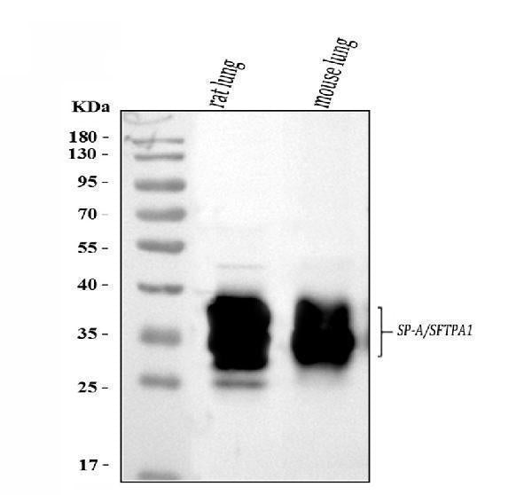 Anti-SFTPA1/2 Antibody Picoband®
