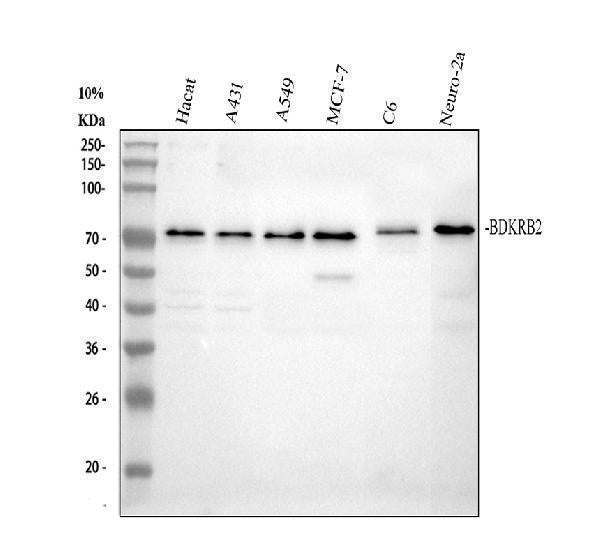 Anti-BDKRB2 Antibody Picoband®