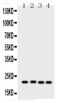 Anti-Picoband antibody, PB, Western blotting
All lanes: Anti SOCS2 (PB9400) at 0.5ug/ml
Lane 1: PC-12 Whole Cell Lysate at 40ug
Lane 2: SW620 Whole Cell Lysate at 40ug
Lane 3: HELA Whole Cell Lysate at 40ug
Lane 4: MCF-7 Whole Cell Lysate at 40ug
Predicted bind size: 22KD
Observed bind size: 22KD