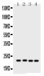Anti-Picoband antibody, PB, Western blotting
All lanes: Anti SOCS2 (PB9400) at 0.5ug/ml
Lane 1: PC-12 Whole Cell Lysate at 40ug
Lane 2: SW620 Whole Cell Lysate at 40ug
Lane 3: HELA Whole Cell Lysate at 40ug
Lane 4: MCF-7 Whole Cell Lysate at 40ug
Predicted bind size: 22KD
Observed bind size: 22KD