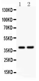 Anti-SOX1 Picoband antibody, PB9403, Western blotting
All lanes: Anti SOX1 (PB9403) at 0.5ug/ml
Lane 1: Rat Brain Tissue Lysate at 50ug
Lane 2: NIH3T3 Whole Cell Lysate at 40ug
Predicted bind size: 39KD
Observed bind size: 39KD