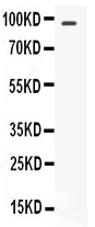 Anti-STAT6 Antibody Picoband®