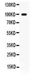 Anti-RANK/TNFRSF11A Antibody Picoband®