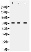 Anti-ABCG5 Antibody Picoband®