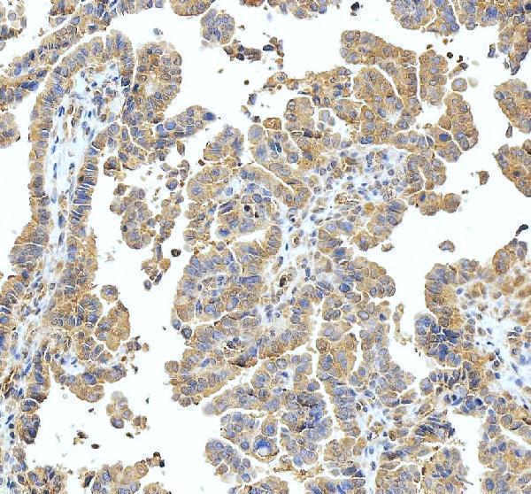 Anti-SSH3BP1/ABI1 Antibody Picoband®