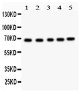 Anti-Acetylcholinesterase/ACHE Antibody Picoband®