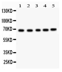 Anti-Acetylcholinesterase/ACHE Antibody Picoband®