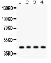 Anti-Adiponectin Receptor 1/ADIPOR1 Antibody Picoband®