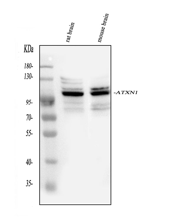 Anti-Ataxin 1/ATXN1 Antibody Picoband®
