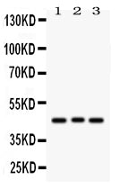 Anti-Ataxin 3/ATXN3 Antibody Picoband®