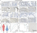 CCNA2 is highly expressed in PRAD and is associated with poor patient prognosis. (A, B) Differential expression of CCNA2 in PRAD. (C) Diagnostic predictive value of CCNA2 in PRAD. (D) KM curve of overall survival of CCNA2 in PRAD. (E) Prognostic predictive value of CCNA2 in PRAD.
Index in PubMed under a CC BY license. PMID: 38947325