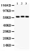 Anti-Heparanase 1/HPSE Antibody Picoband®