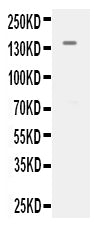 Anti-VEGF Receptor 2/KDR Antibody Picoband®