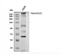 Anti-Plectin Antibody Picoband®