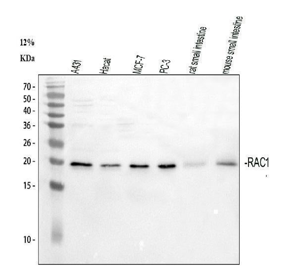 Anti-Rac1 Antibody Picoband®