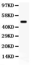 Anti-SGK1 Antibody Picoband®