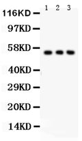 Anti-Glucose Transporter GLUT2/SLC2A2 Antibody Picoband®