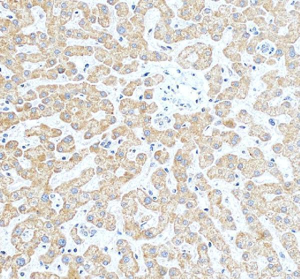 Anti-SLUG/SNAI2 Antibody Picoband®