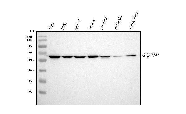 Anti-SQSTM1/p62 Antibody Picoband®