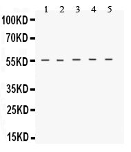 Anti-Neurokinin 1 Receptor/TACR1 Antibody Picoband®