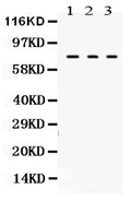 Anti-Transglutaminase 2/TGM2 Antibody Picoband®