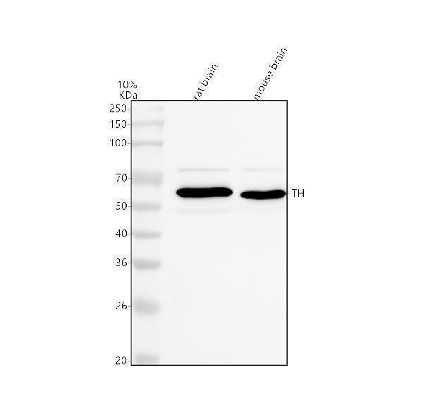 Anti-Tyrosine Hydroxylase/TH Antibody Picoband®