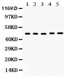 Anti-Vitamin D Receptor/VDR Antibody Picoband®