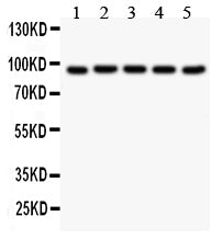 Anti-Villin/VIL1 Antibody Picoband®