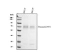 Anti-Vitronectin/VTN Antibody Picoband®