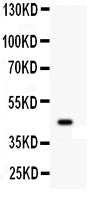 Anti-Wnt2b Antibody Picoband®