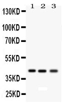 Anti-RAGE/AGER Antibody Picoband®