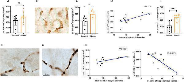 Anti-Aquaporin 4/AQP4 Antibody Picoband®