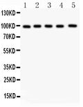 Anti-Aspartate beta hydroxylase/ASPH Antibody Picoband®