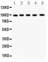 Anti-Aspartate beta hydroxylase/ASPH Antibody Picoband®