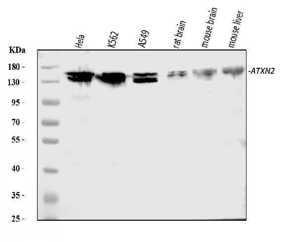 Anti-ATX2/ATXN2 Antibody Picoband®