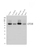 Anti-CPT1B Antibody Picoband®