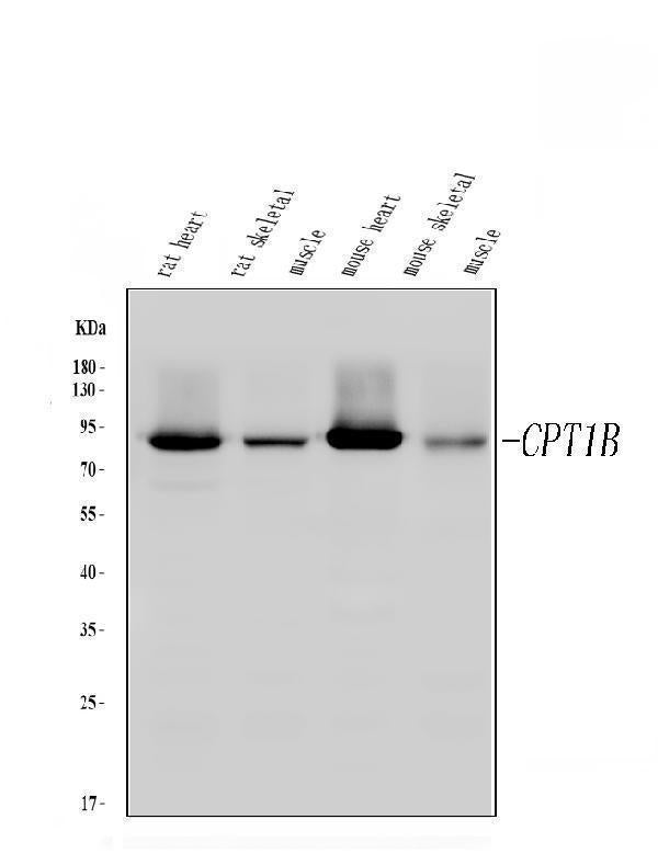 Anti-CPT1B Antibody Picoband®