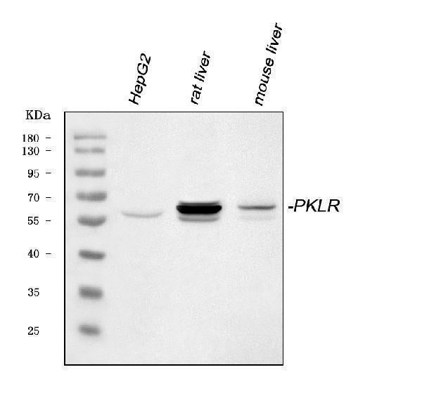 Anti-PKLR Antibody Picoband®