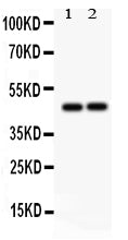 Anti-TCPTP/PTPN2 Antibody Picoband®