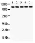 Anti-SOX5 Antibody Picoband®
