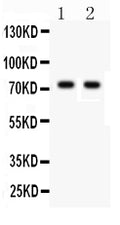 Anti-TNF Receptor II/TNFRSF1B Antibody Picoband®