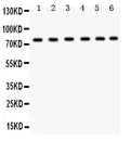 Anti-TRPV5 Antibody Picoband®