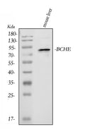Anti-Butyrylcholinesterase/BCHE Antibody Picoband®