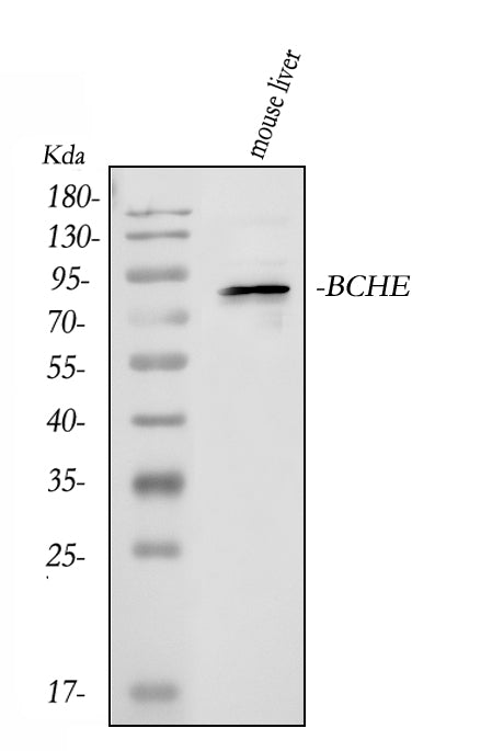 Anti-Butyrylcholinesterase/BCHE Antibody Picoband®